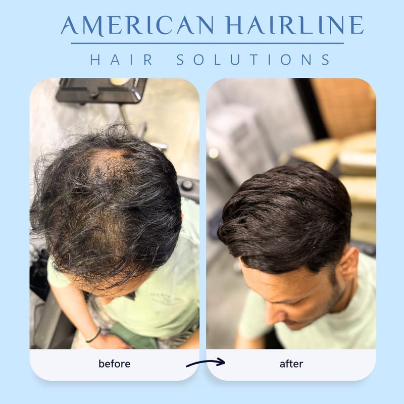 Before-and-after views of thinning and fuller styled hair